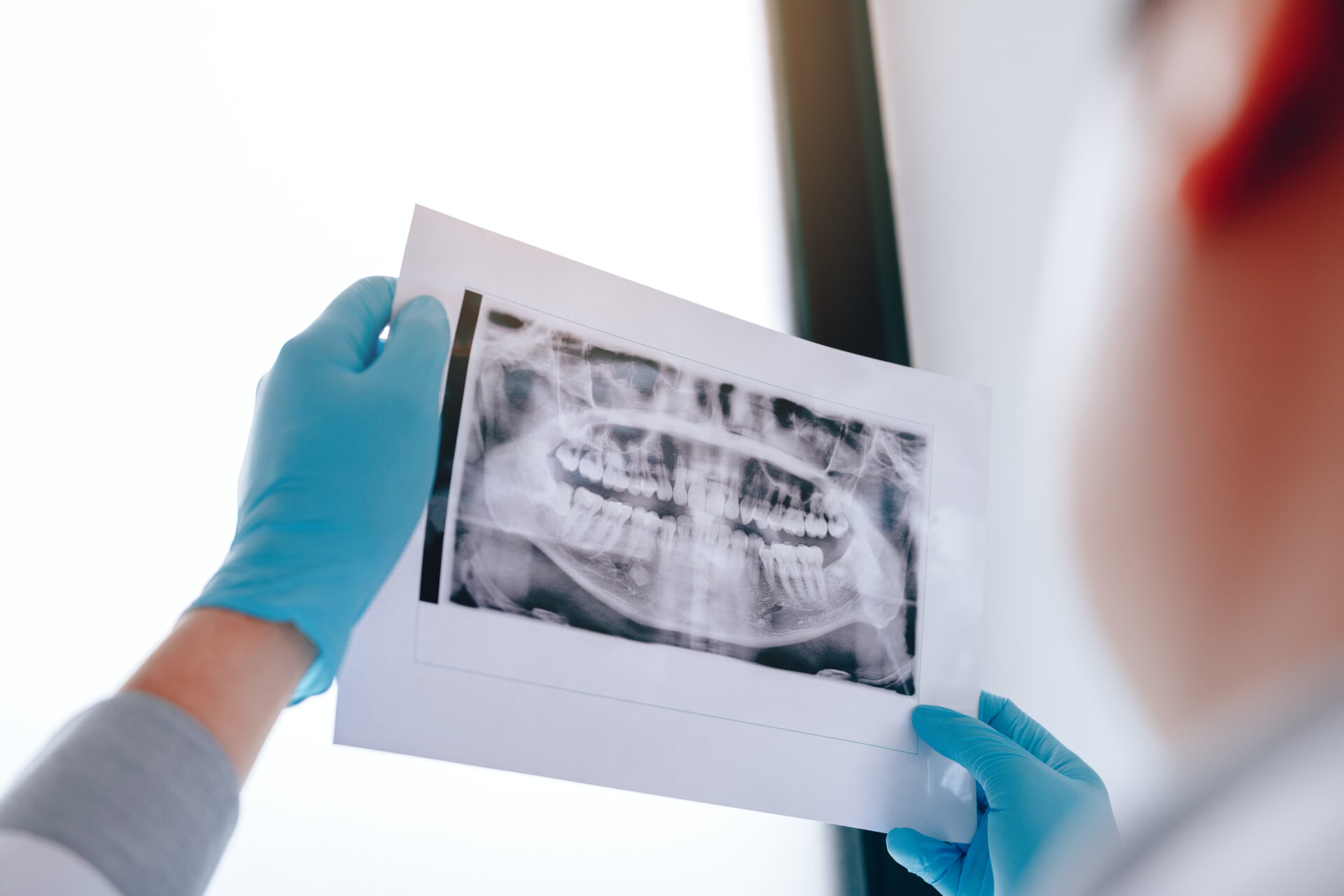 Gloved hands holding a full-mouth X-ray