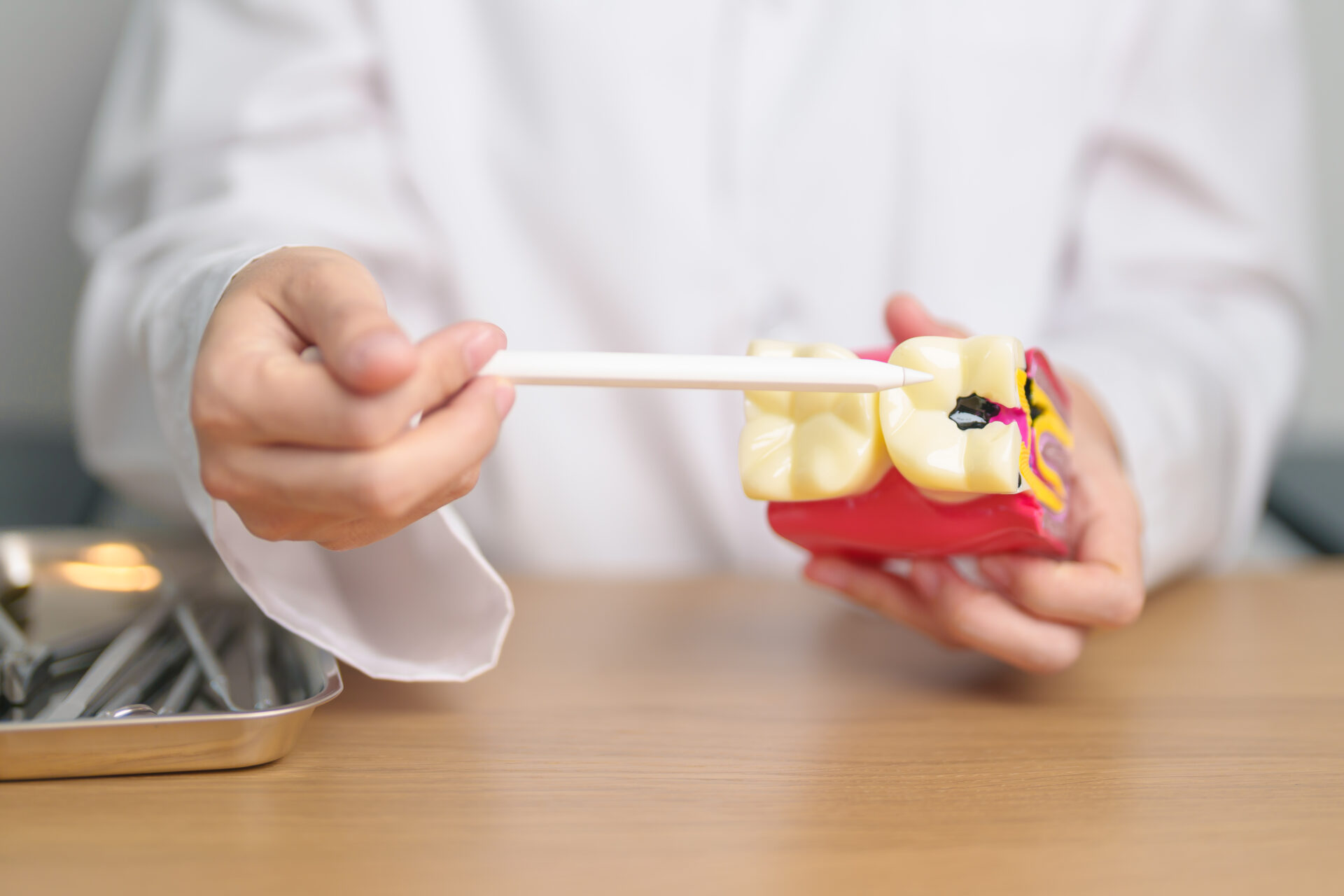 Hands pointing to a spot of decay on a model tooth