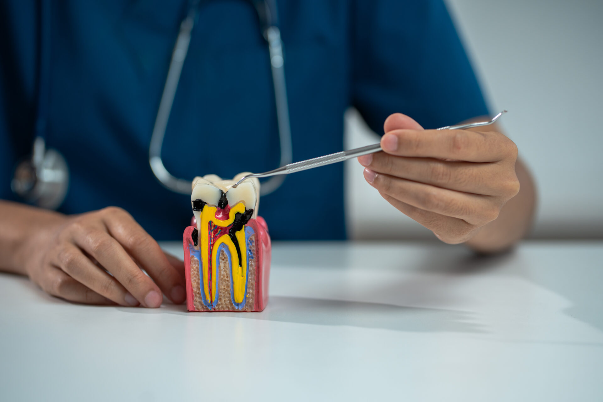 Model of a tooth cut open to show the nerve and roots inside